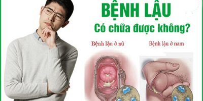 bac-si-hon-40-nam-kinh-nghiem-lam-ro-benh-lau-co-chua-duoc-khong