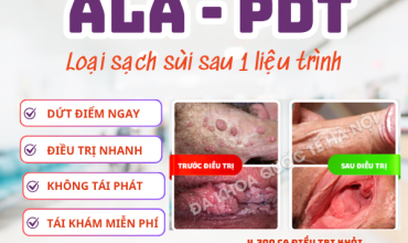 sui-mao-ga-co-dau-khong-tu-not-nho-den-mang-sup-lo-muc-do-dau-nhan-biet-nhu-the-nao