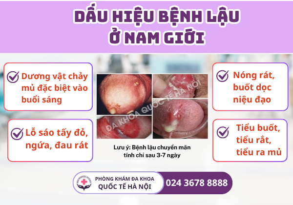 dấu hiệu bệnh lậu ở nam