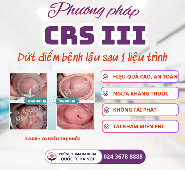 phương pháp chữa lậu