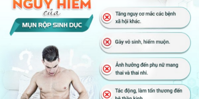 mun-rop-sinh-duc-bac-si-huong-dan-nhan-biet