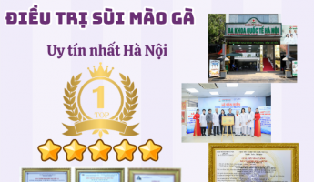 so-sanh-cac-phuong-phap-dieu-tri-sui-mao-ga-hien-nay