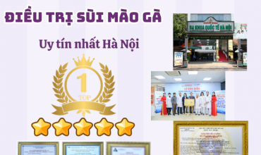 so-sanh-cac-phuong-phap-dieu-tri-sui-mao-ga-hien-nay