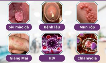 chuyen-gia-canh-bao-cac-benh-tinh-duc-o-nam-gioi-co-xu-huong-gia-tang-tim-hieu-ngay-de-biet-cach-phong-tranh