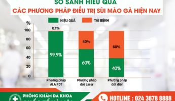 su-that-ve-dot-sui-mao-ga-90-nguoi-benh-hieu-sai-dieu-nay