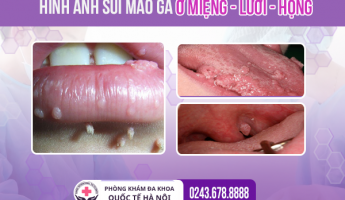 tong-hop-hinh-anh-sui-mao-ga-that-o-nam-nu-khien-ai-cung-phai-canh-giac