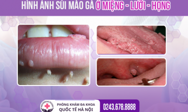 tong-hop-hinh-anh-sui-mao-ga-that-o-nam-nu-khien-ai-cung-phai-canh-giac