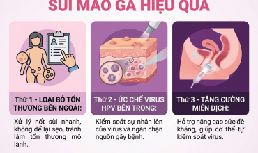 hieu-dung-cach-chua-sui-mao-ga-o-nu-de-tranh-roi-vao-vong-lap-dieu-tri