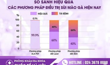 su-that-ve-dot-sui-mao-ga-90-nguoi-benh-hieu-sai-dieu-nay