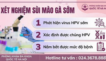 xet-nghiem-sui-mao-ga