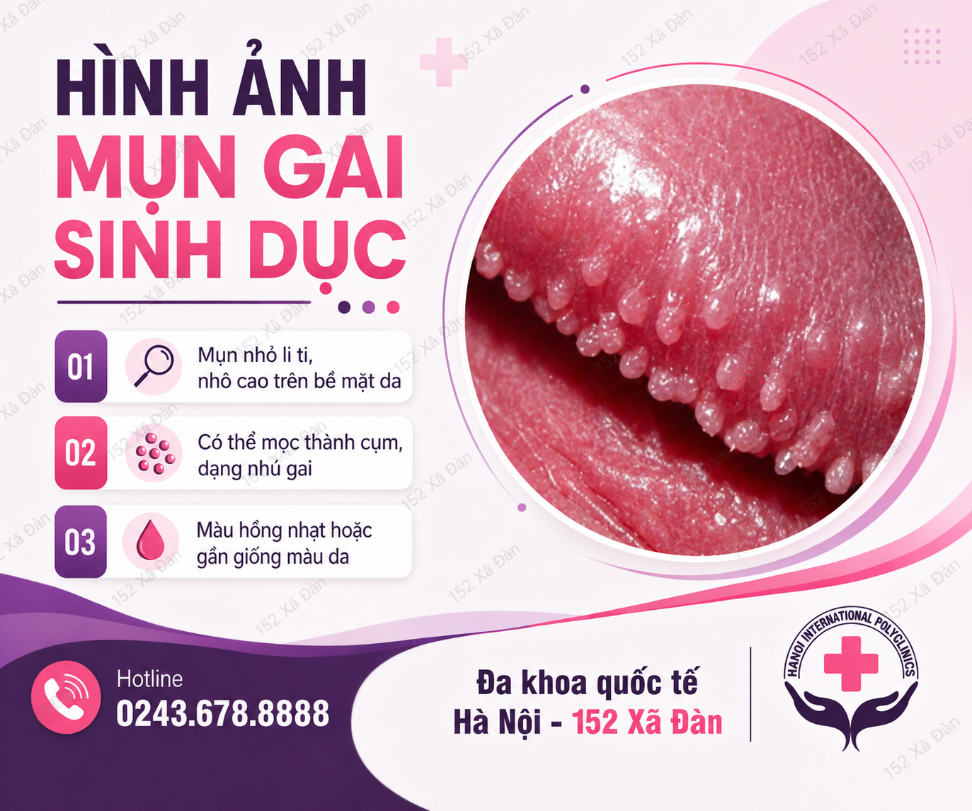 tuong-mun-gai-sinh-duc-hoa-ra-sui-mao-ga-chu-quan-vai-not-nho-nhan-ket-qua-bang-hoang-khi-di-kham